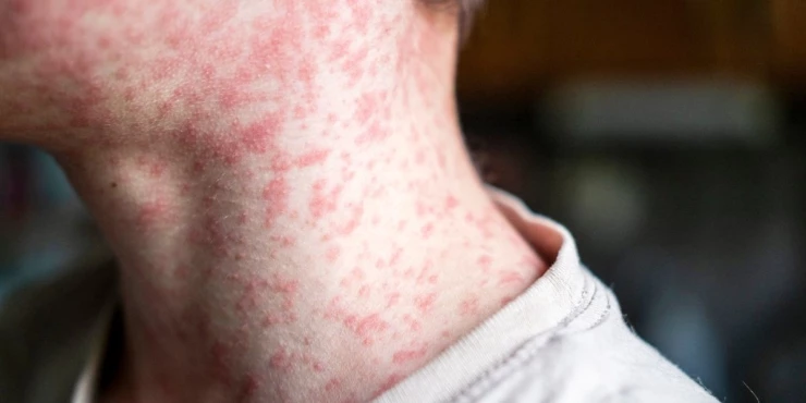 1261562 shutterstock 2460102253 m.webp.webp