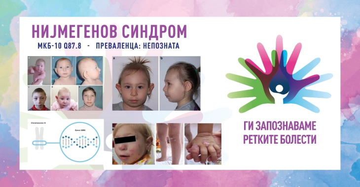 20260206084635 big 730x400 47.webp.webp