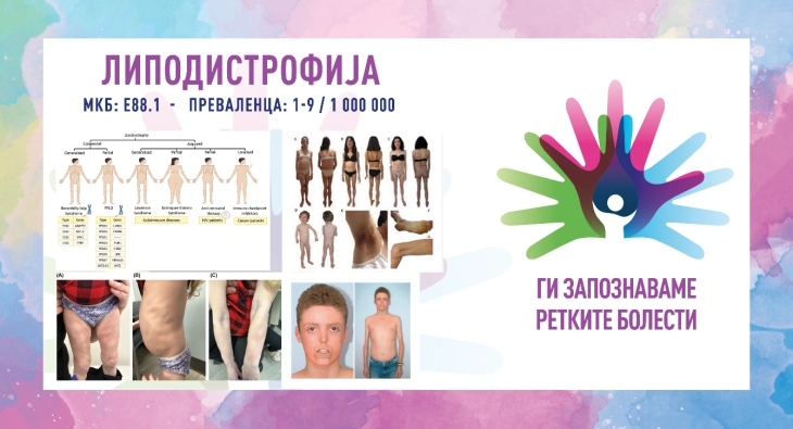 20260208221133 big 730x400 13.webp.webp