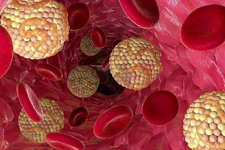 20260327094749 big 730x400 34.webp.webp