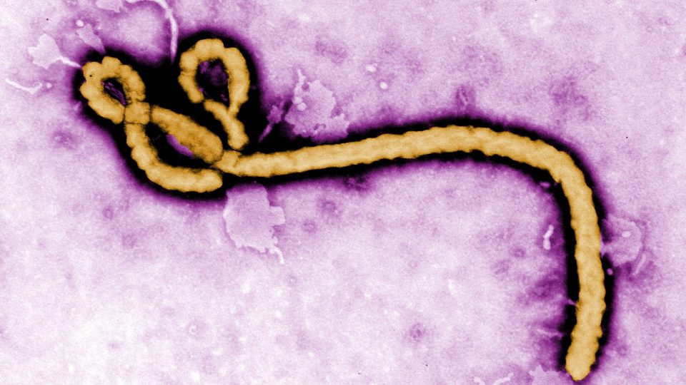 Ebola virus purple.jpg